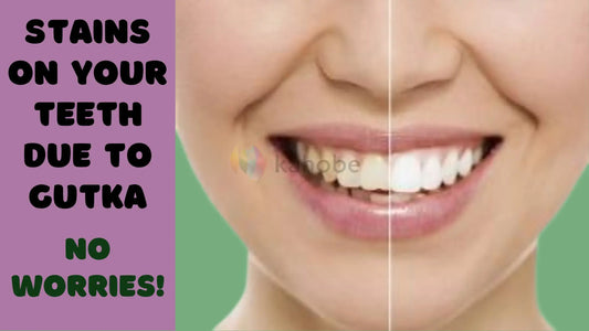 The Best Gutka Stain Remover for Teeth in 2024