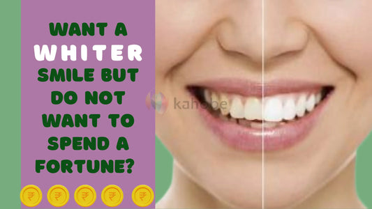 Best alternative to high cost permanent teeth whitening
