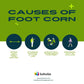 Causes of foot corn - feet corn removal serum